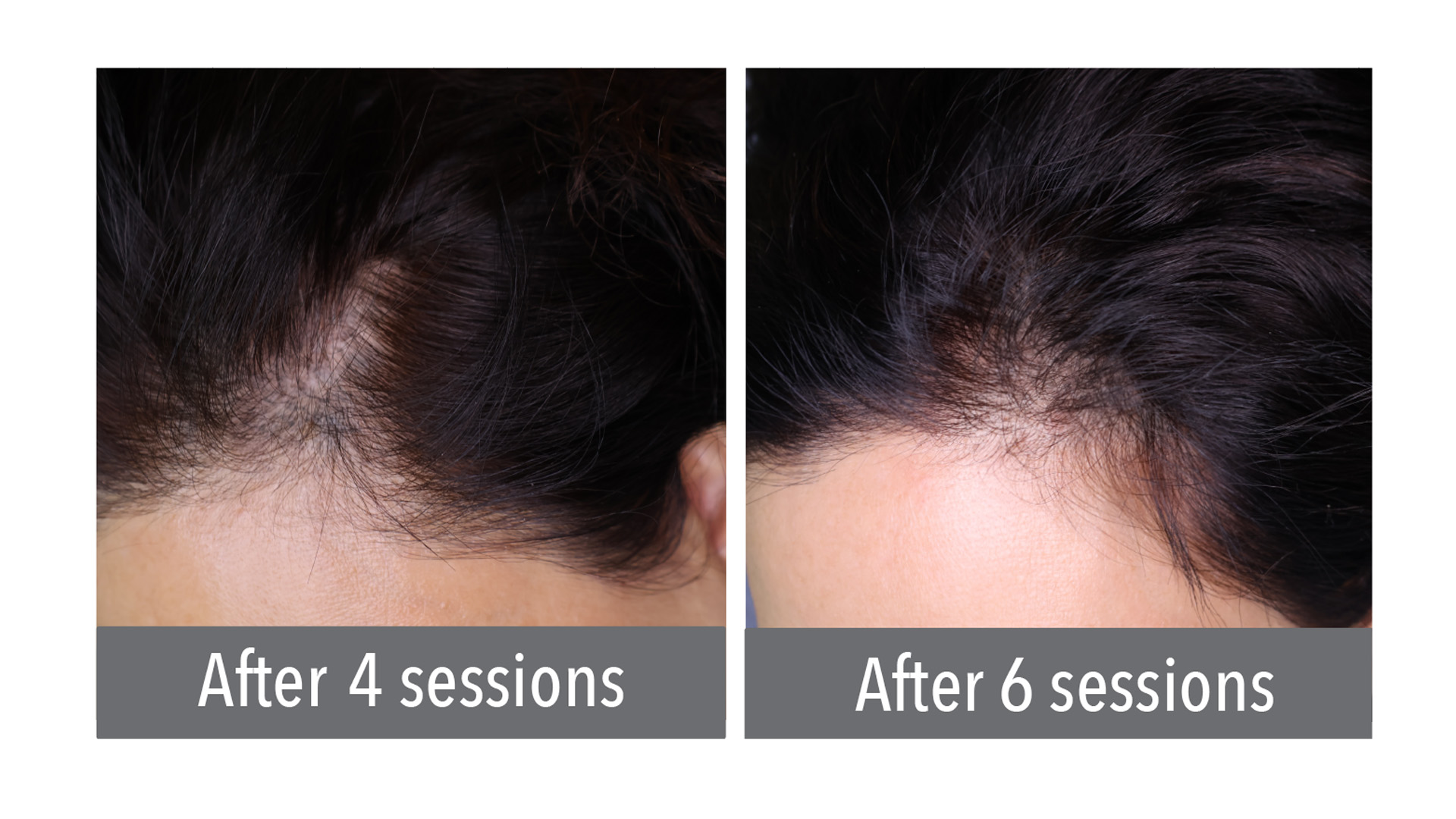 Hair Follicle Diagram