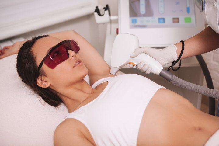 A woman is having laser hair removal performed in Bangkok.