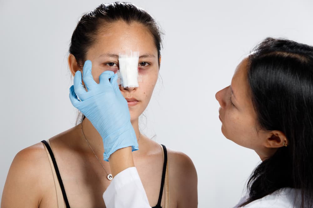 Rhinoplasty surgery needs several weeks of recovery time.