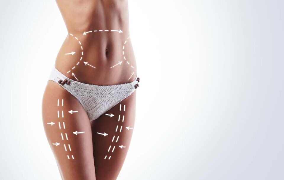 Experience a trimmer, healthier you with VASER liposuction.