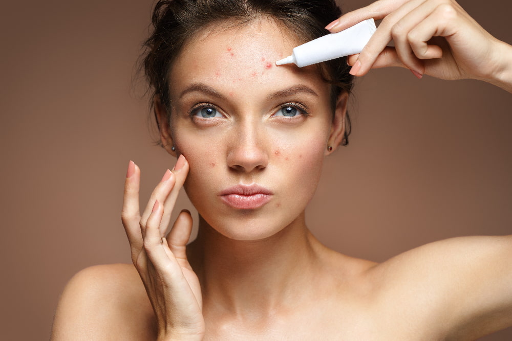 It is important to consider your hormone levels when choosing the right acne treatment.