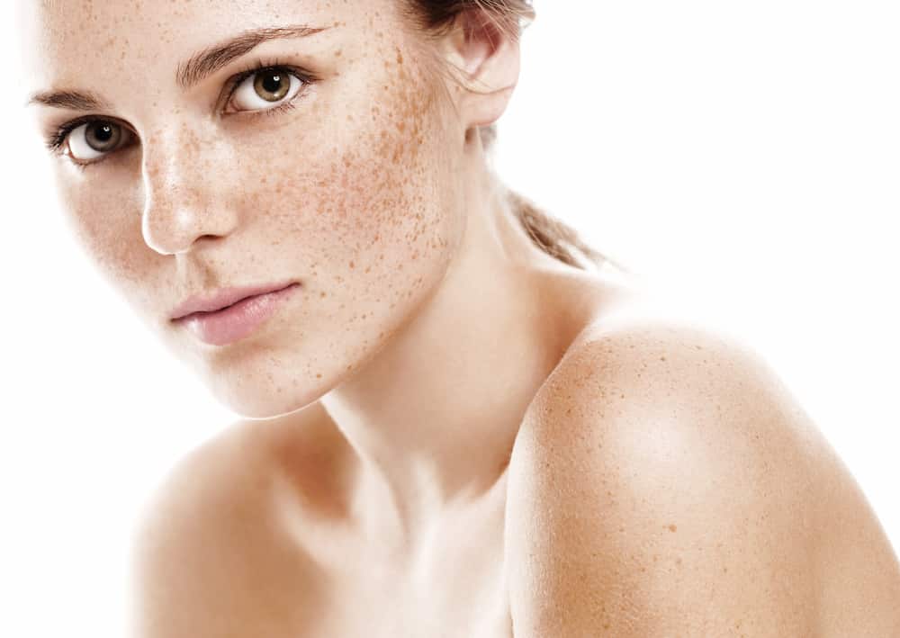 Sun exposure can cause freckles.