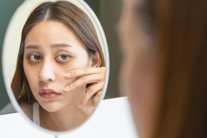 Woman with dark eye circles looking in a mirror