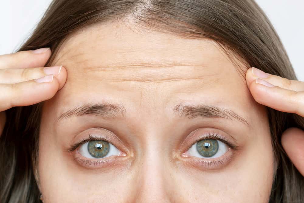 A young woman with forehead lines