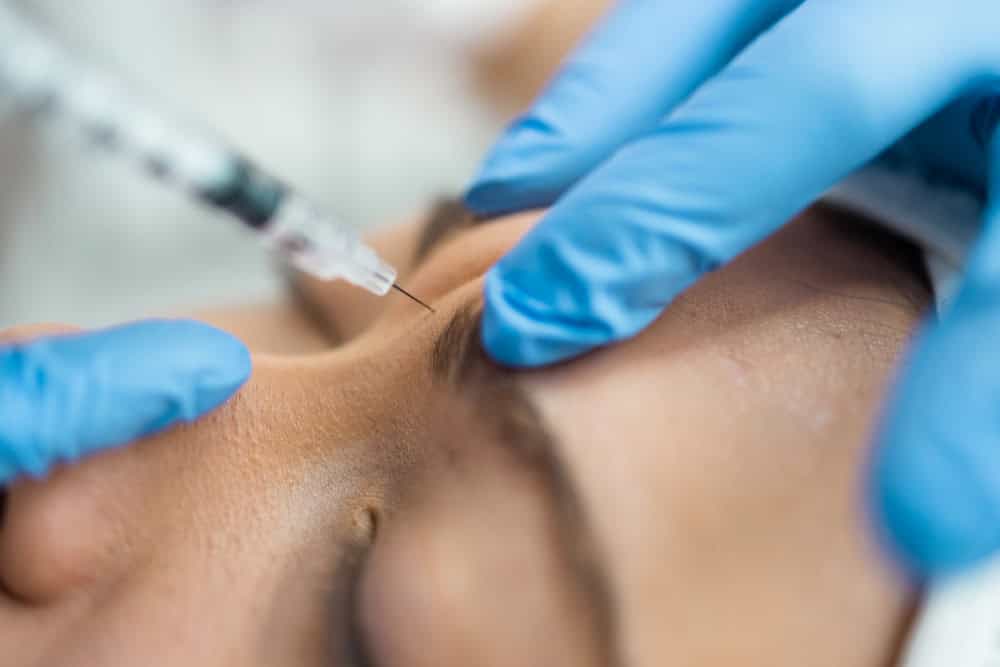 Close-up of a Botox injection between the eyebrows