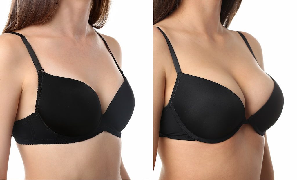 Get breast lift and augmentation surgery in Bangkok