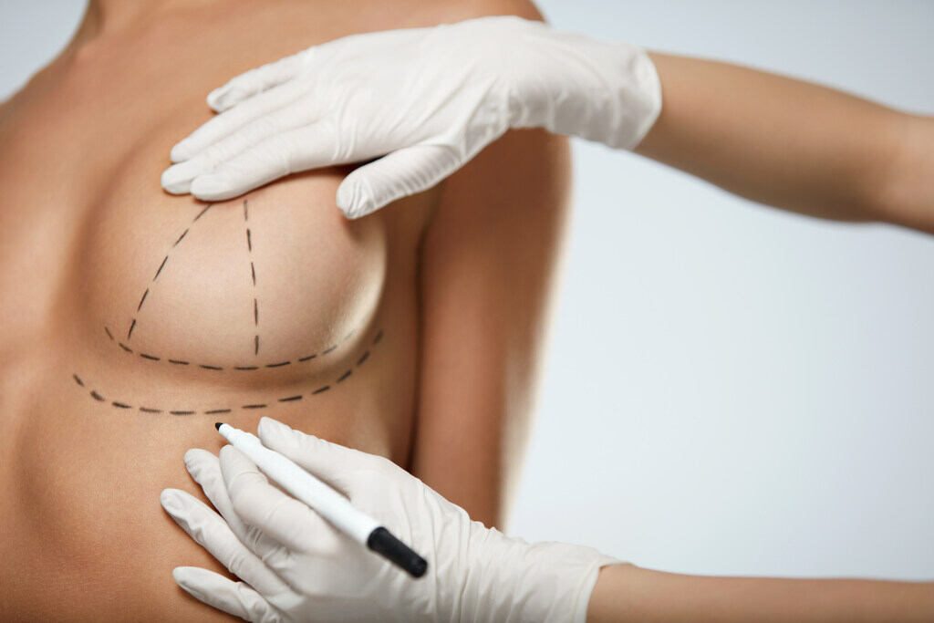 breast augmentation in thailand