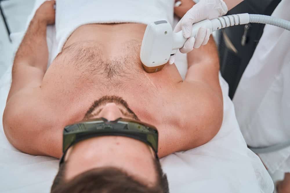 Man undergoing male laser hair removal