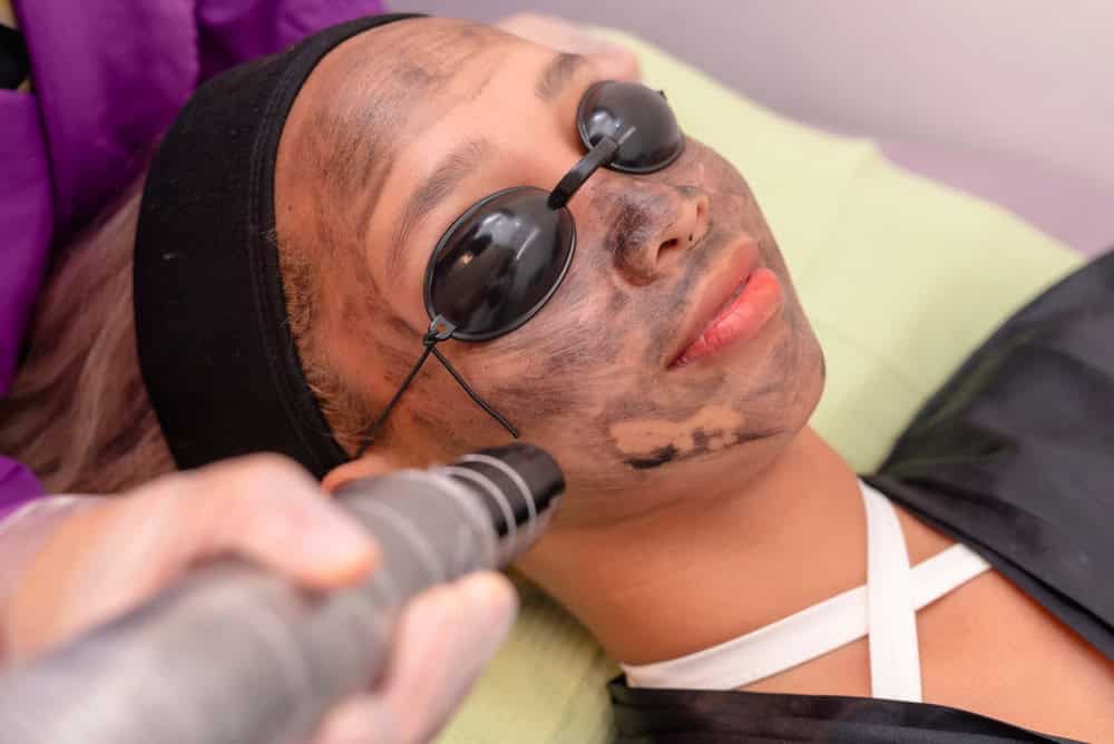 A lady undergoing a pico laser treatment procedure