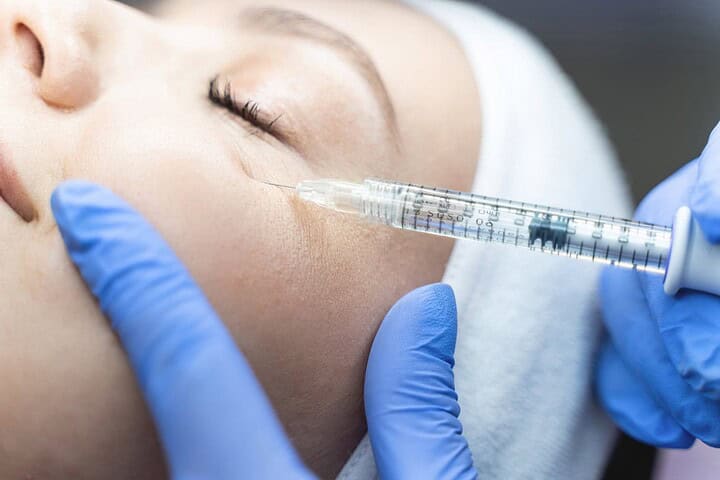 A patient getting a Juvelook undereye treatment