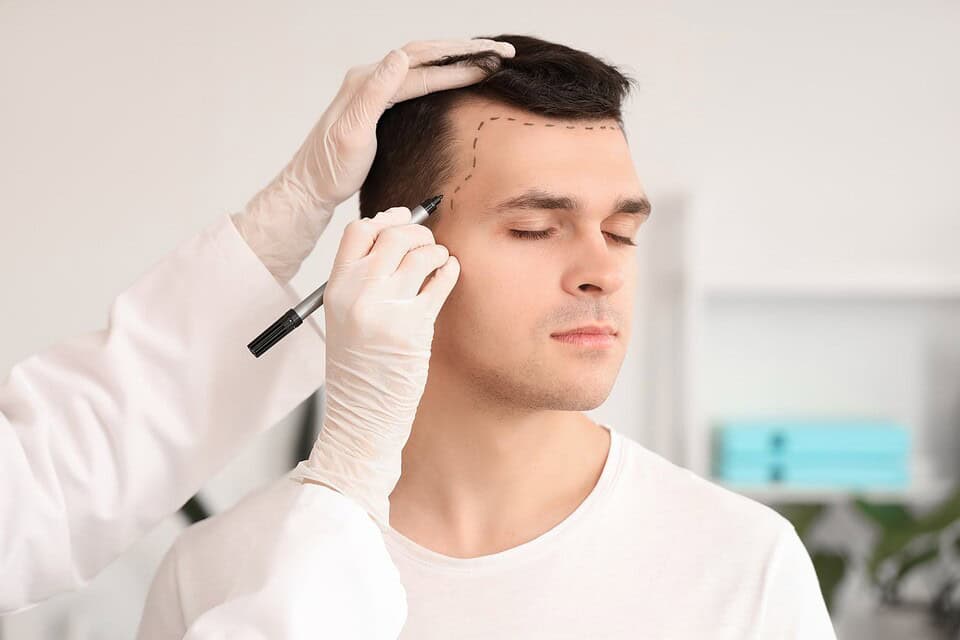 A patient at a hair transplant clinic in Bangkok