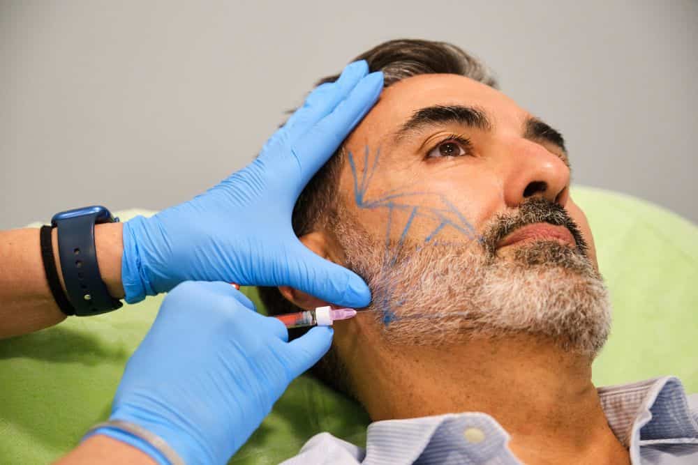 A man improves his look with cheek fillers