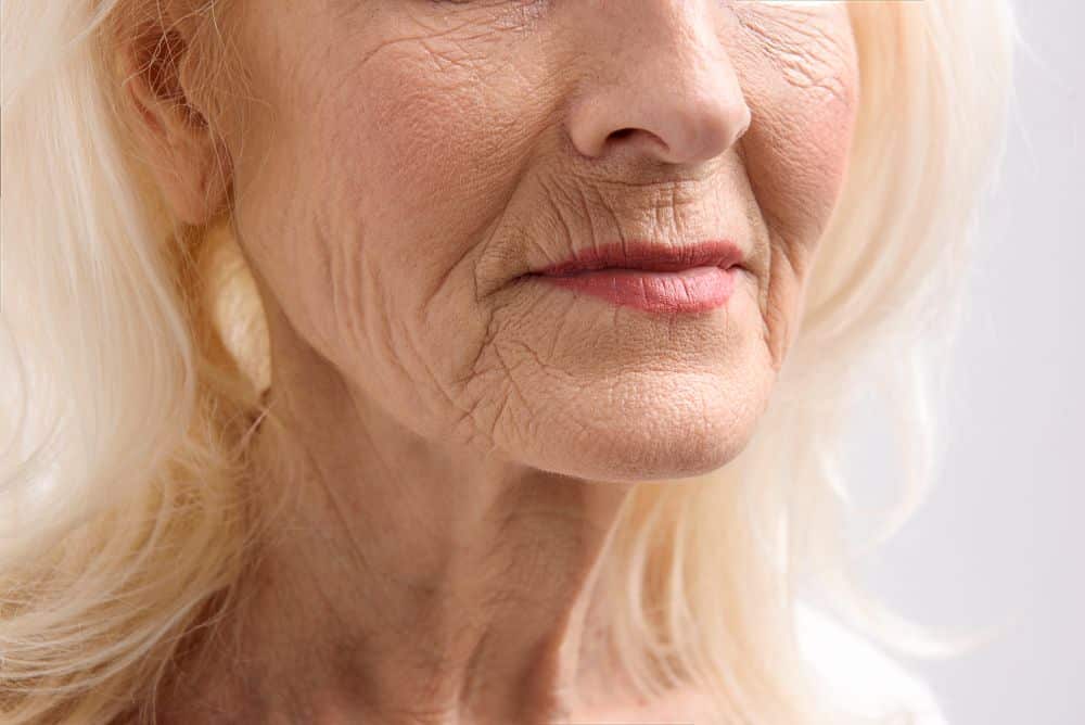 The platysma muscle can weaken and cause turkey neck