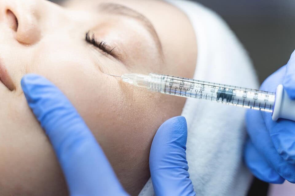 A woman receiving fillers for dark circles