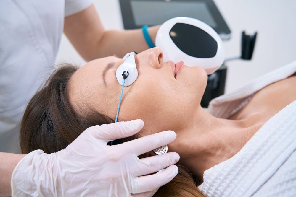 Lasers can safely remove facial freckles permanently