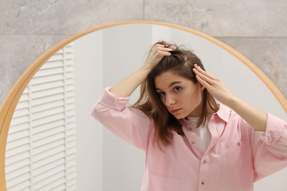A woman suffering from hair loss