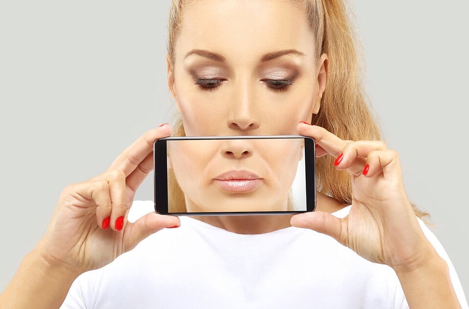 Woman holding a smartphone showing a before close-up of marionette lines around her mouth