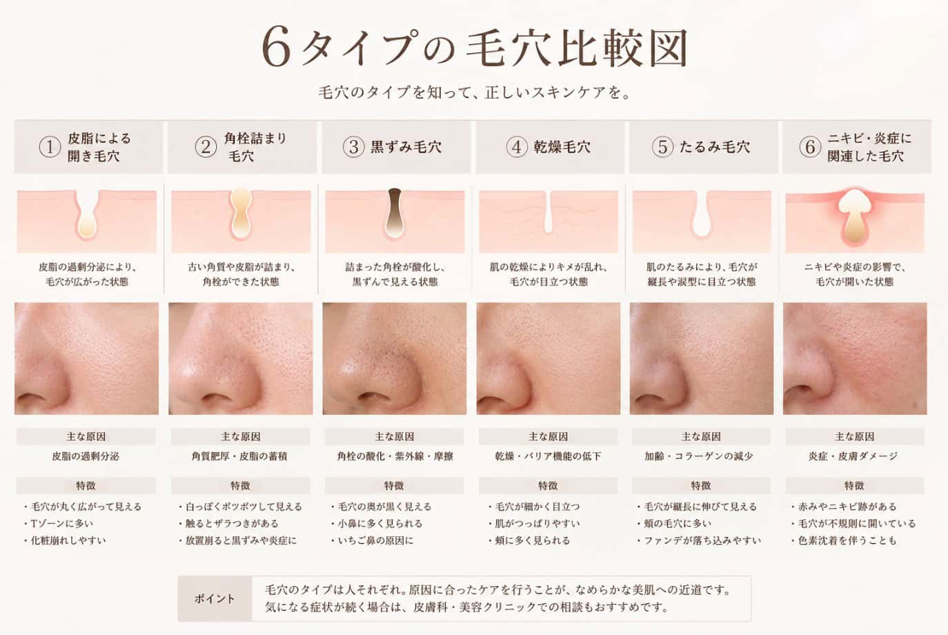 毛穴にも種類がある?目立つ毛穴のタイプと原因の違い